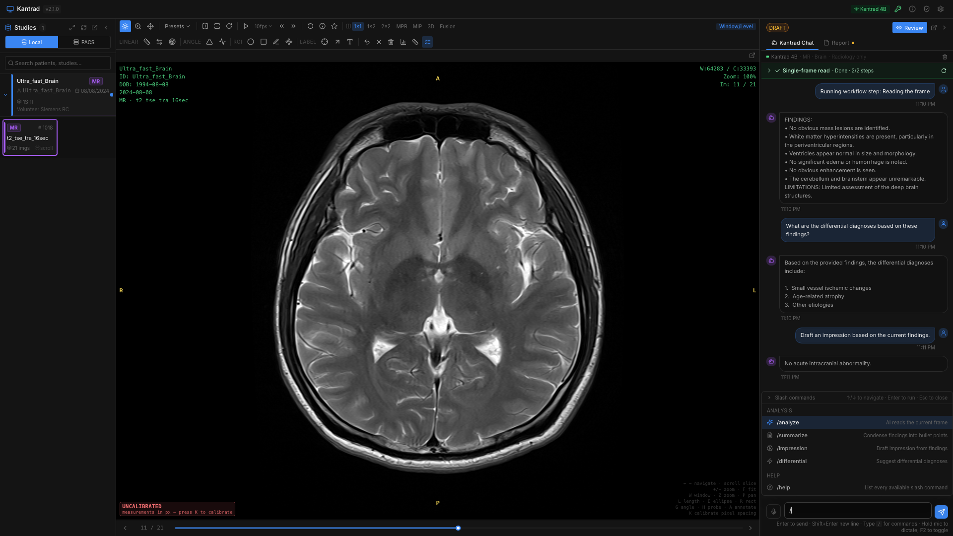 Study-aware AI
