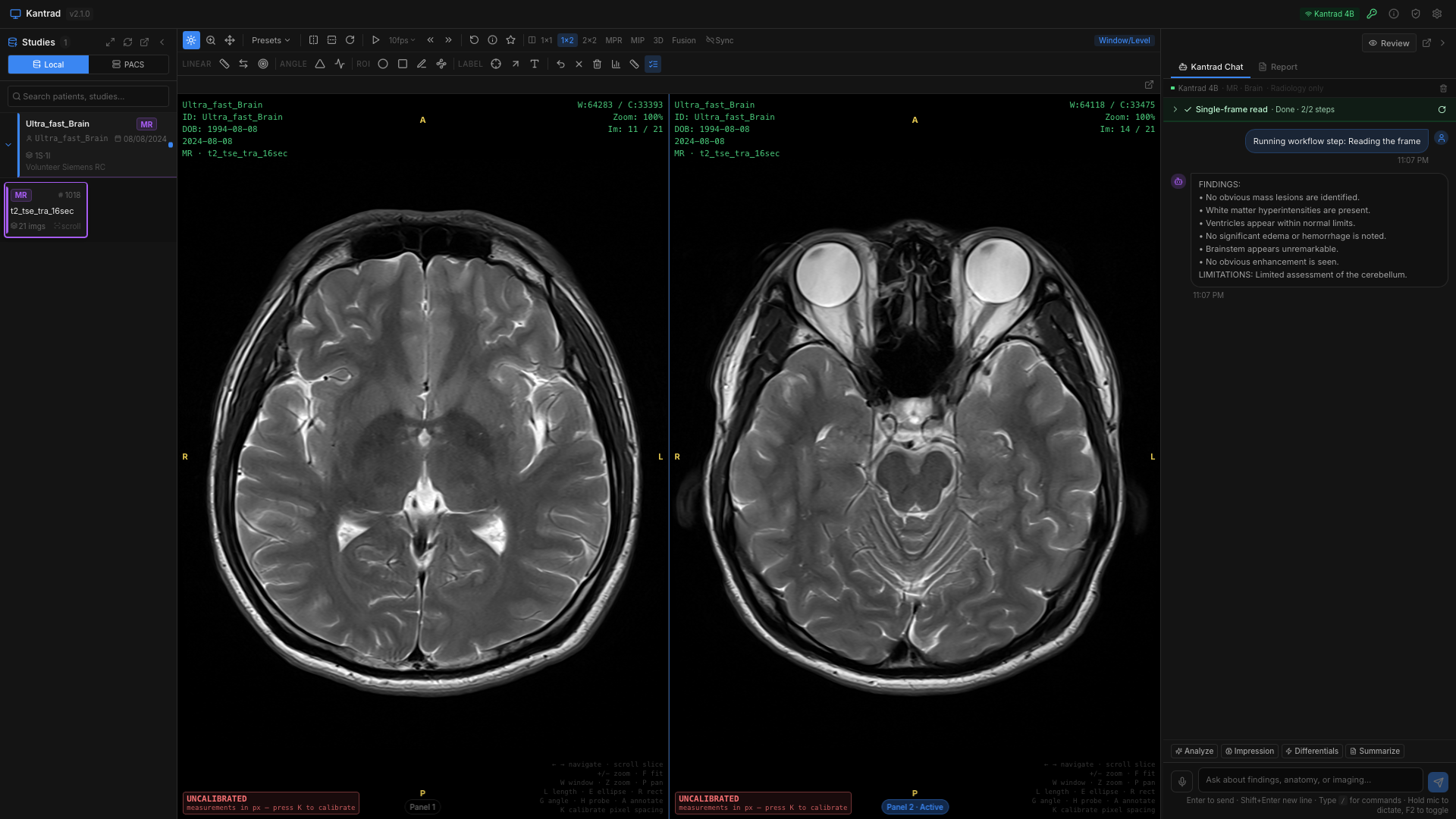 Multi-viewport